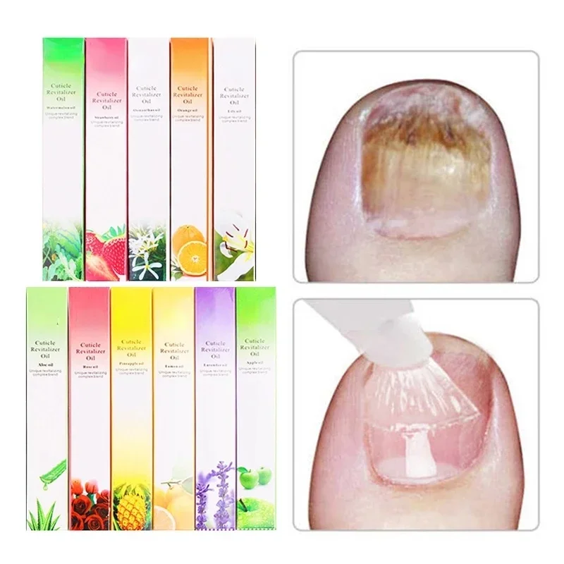 6 STKS Nagelriemolie Pen Nagel - Cuticle Oil Pen recensie en prijs